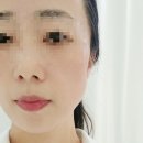 더이쁜피부 이미지