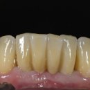 엠웍스 치과기공소 이미지