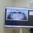 마산뉴치과의원 네이버블로그