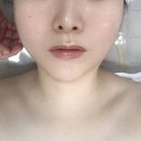 터치미인 | [피부미인] 세심한 터치 윤곽관리 후기 간석동 피부관리
