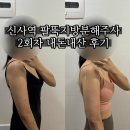 지방분해주사 신사역 팔뚝주사 내돈내산 부유방 팔뚝지방분해주사 2회차 후기 🖤(멍, 통증, 식단, 효과, 술)