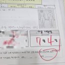 안산 제이미의원 턱보톡스 후기, 아침 턱 통증이 줄어든 이유