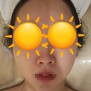 아벨메디칼 | 정관피부관리실 기장 아벨에스테틱 브레인테라피 후기