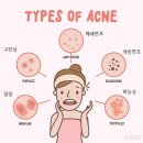 서울화봄의원 이미지