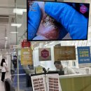 개인(서광명) | 광명발각질 굳은살 제거 만족 후기 오벨리네일푸스 족보있는그녀들 금천점