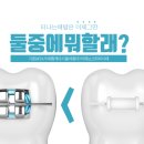스티치킹콩 이미지