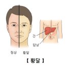 총담관 결석(CBD stone) 이미지