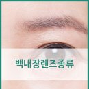 청라베스트안과의원 네이버블로그