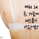 가슴 뾰루지, 가슴 여드름 원인 및 가드름 예방법 이미지