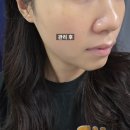뷰티다해 | 병점 피부관리 뷰티다해 마이크로웨이브 온다리프팅 솔직후기