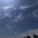 (주)휴비스전주공장(본) | [전주피부과] 피부 저속 노화관리, 줄기세포주사 내돈내산 시술 찐후기 (효과, 통증, 가격, 주기 총정리)