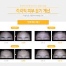 힐링피부사랑 이미지