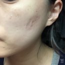 라이라즈 환절기크림 익모초크림 사용 후기