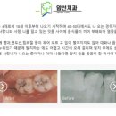 삼산앞선치과의원 네이버블로그