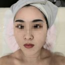 서면아쿠아필 잘하는 곳 예쁘리 서면 피부관리 서면에스테틱 추천