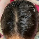 헤어ZN | 려 루트젠 헤어볼륨필러, 정수리볼륨 올리브영 추천템 사용 후기!