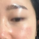 미백세탁소 | 피부리셋 프로젝트 쫀득한 모공관리 트라이엄 - 아나토미 에스테틱 타워팰리스 도곡점