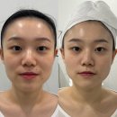 아미샵()옛날통닭 | 대구 피부관리 "아미뷰티센터" 솔직한 후기(+얼굴형별 리프팅 추천, 셀룩스PRO)