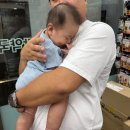 하트성형외과의원 | 6개월 아기 선천성 멜라닌모반 수술 후기 | 대구 닥터지니성형외과