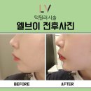 엘브이의원 이미지