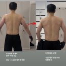 세븐일레븐(마산선진빌딩점) | 댓거리 PT | 승모근 통증과 어깨 비대칭, 17일 만에 교정 성공한 회원님의 리얼 후기!