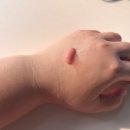 명현약국 | [핑크멀티젤] 건선과 지루성 두피부터 발끝 사용 가능한 천연 보습 크림