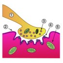 myasthenia gravis(2) 이미지
