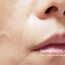 사무엘솔루션 | 성장호르몬 동종요법 추천 3H 부스터 액티브 세럼