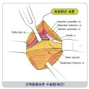 연령대별 맞춤 인공관절수술 80대도 가능 (웰튼병원 - ＞ 인공관절수술) 이미지