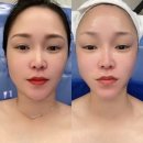 창원얼굴경락 안면비대칭교정잘하는 곳 예담에스테틱 방문후기