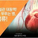 전조증상 없이 터질 수 있는 복부대동맥류 이미지