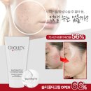 할인 공구 OPEN - 365일 여드름 달고 사는 에스테틱 원장의 여드름 흉터 재생관리 리얼 후기 보여드릴게요