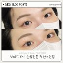 보떼 드 조이