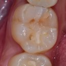 현재만치과의원 | 양심치과 리스트에 대한 치과 원장의 리얼 경험담