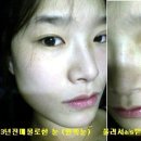 리매몰