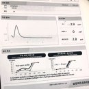[노원] 삼성조은내과 내돈내산 SIBO 치료 후기, 수소수치 37.7 → 2로 떨어졌어요