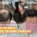 동경헤어 - 해운대구 윗반송로51번길 221 | 남녀노소 만족하는 부산 남천동 가발 잘하는 곳 에이스 가발 동경헤어 고객님들의 실제 후기 !