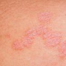 소잠한의원 이미지