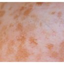 목포제일의원 | 목포 토닝, 후기 피코토닝 레이저 추천하는 이유 총정리