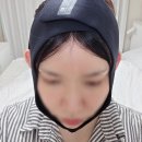 영메디케어 | 얼굴 리프팅 밴드, 정말 이중턱에 효과 있을까? 사용 전후 비교해 봤어요