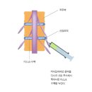 카이모 이미지