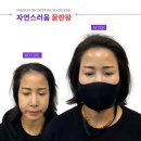 잉크본 이미지