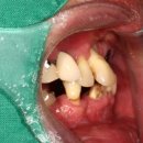 치아룸 치과기공소 이미지