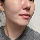 송탄 피부관리 잘하는 디또뷰티 방문후기