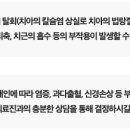 서울더바른치과교정과치과의원 네이버블로그