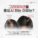 제이J스칼프 | 홍대두피문신 어디서 받아야 성공할수 있는지 고민중이신가요?