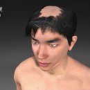 [992회]생로병사의 비밀/[어느 날 갑자기,탈모가 시작됐다]머리를 감을 때마.다,빗질할 때마다 조용히 빠지고 있는 머리카락,... 이미지