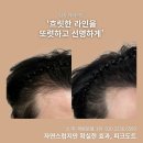 두피공방헤어라인 | 남성두피문신 정수리 헤어라인 후기, 자연스러운 변화로 달라진 인상