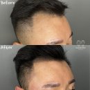 채움샵