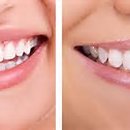 서울하나로치과의원 이미지